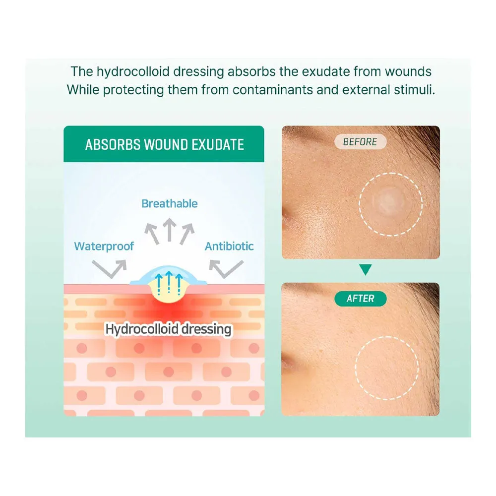 Clear Spot Patch