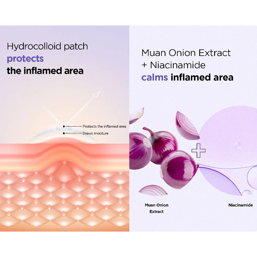 Onion Newpair Spot Patch [SKIN FIT] 15patches