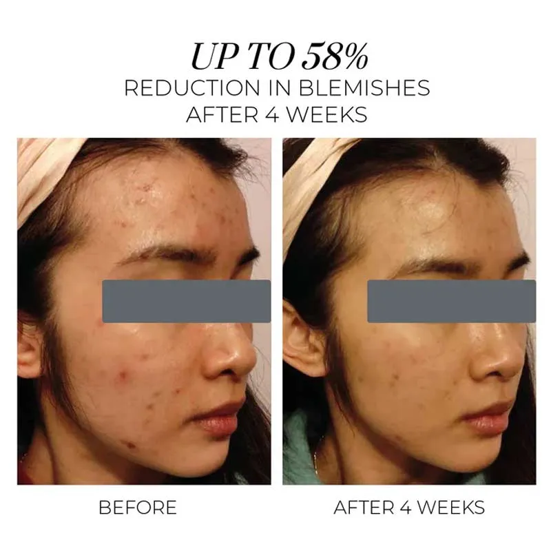 OSKIA Violet Water Hydra-Gel Clarifying Daily Moisturiser