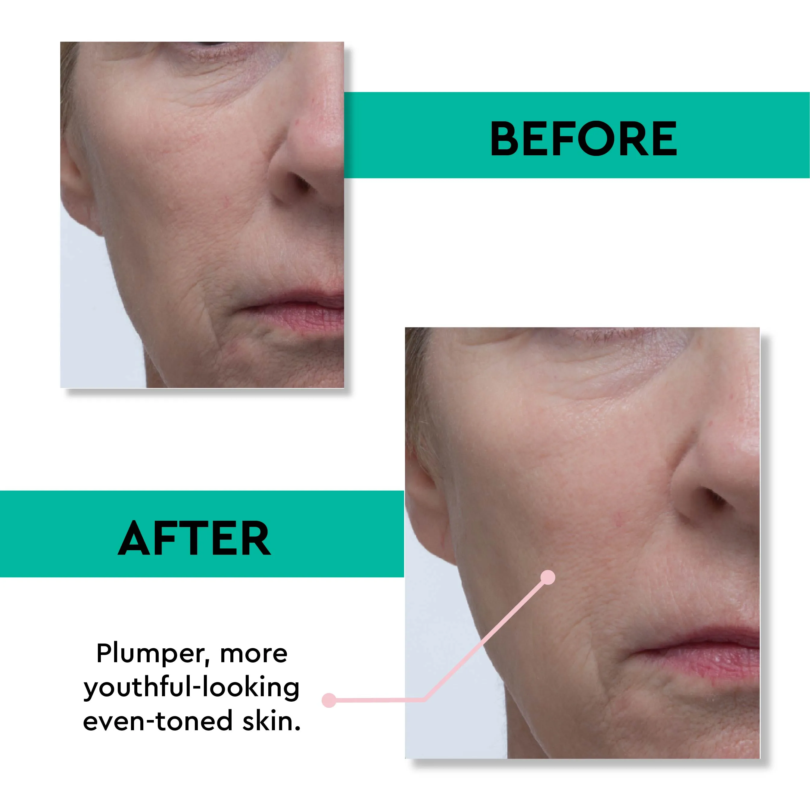 Retinol Rescue Overnight Cream